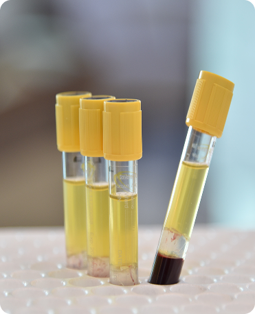Patient receiving PRP therapy treatment